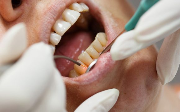 Diş Hekimliğinde Lazerli Uygulamalar
